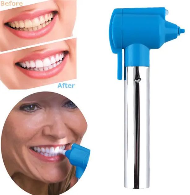 Отбеливатель зубов Luma Smile, набор для отбеливания зубов, комплексное отбеливание и полировка зубной эмали, компактное устройство с насадками, удаляет пожелтевший налет, белоснежная улыбка на дому