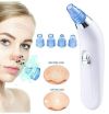 Вакуумный аппарат для чистки лица и пор Derma Suction для профессиональной чистки кожи и пор лица - легкий портативный удобный прибор + 4 насадки, Вакуумный очиститель для самостоятельной очистки в домашних условиях