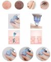 Вакуумный аппарат для чистки лица и пор Derma Suction для профессиональной чистки кожи и пор лица - легкий портативный удобный прибор + 4 насадки, Вакуумный очиститель для самостоятельной очистки в домашних условиях