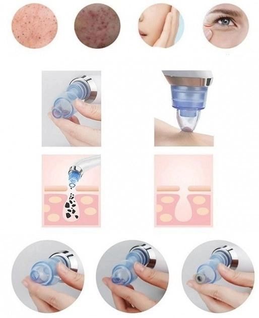 Вакуумный аппарат для чистки лица и пор Derma Suction для профессиональной чистки кожи и пор лица - легкий портативный удобный прибор + 4 насадки, Вакуумный очиститель для самостоятельной очистки в домашних условиях