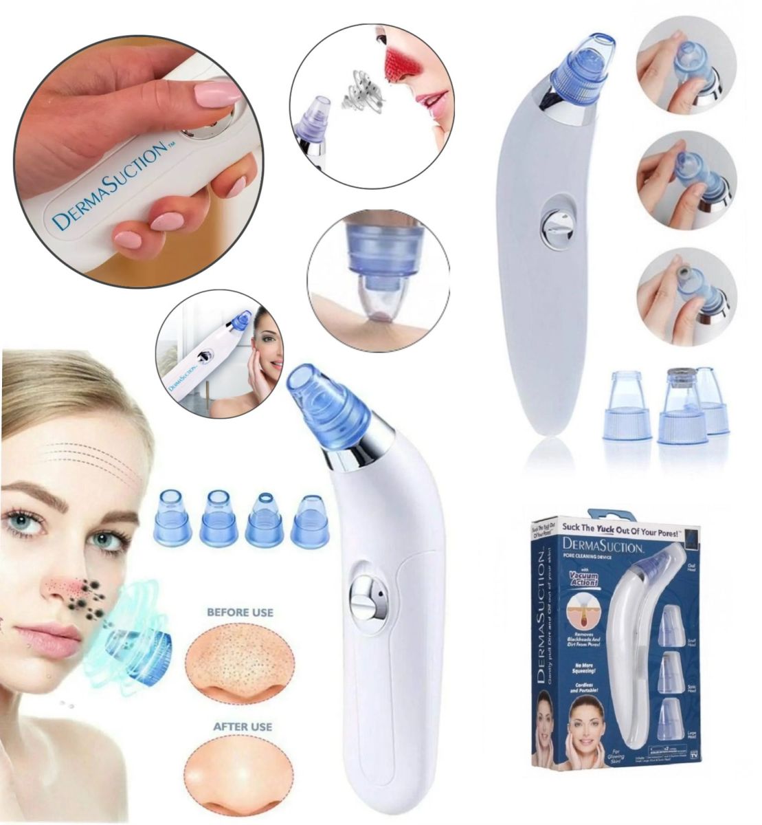 Вакуумный аппарат для чистки лица и пор Derma Suction для профессиональной чистки кожи и пор лица - легкий портативный удобный прибор + 4 насадки, Вакуумный очиститель для самостоятельной очистки в домашних условиях