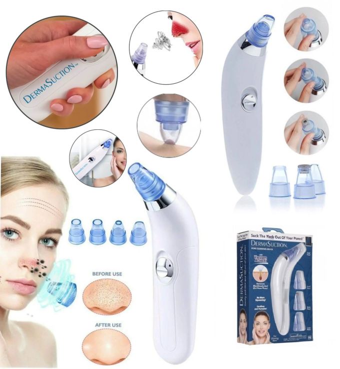 Вакуумный аппарат для чистки лица и пор Derma Suction для профессиональной чистки кожи и пор лица - легкий портативный удобный прибор + 4 насадки, Вакуумный очиститель для самостоятельной очистки в домашних условиях