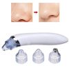 Вакуумный аппарат для чистки лица и пор Derma Suction для профессиональной чистки кожи и пор лица - легкий портативный удобный прибор + 4 насадки, Вакуумный очиститель для самостоятельной очистки в домашних условиях