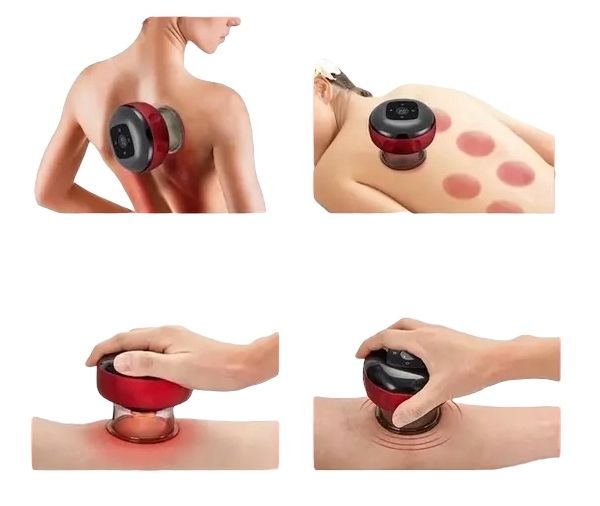 Массажер Cupping Massager с эффектом банок для тела, Антицеллюлитный массажер с интенсивным согреванием, массажная терапия, Акупунктурный, лимфодренажный, расслабляющий Электрический универсальный Вакуумный Баночный Массаж